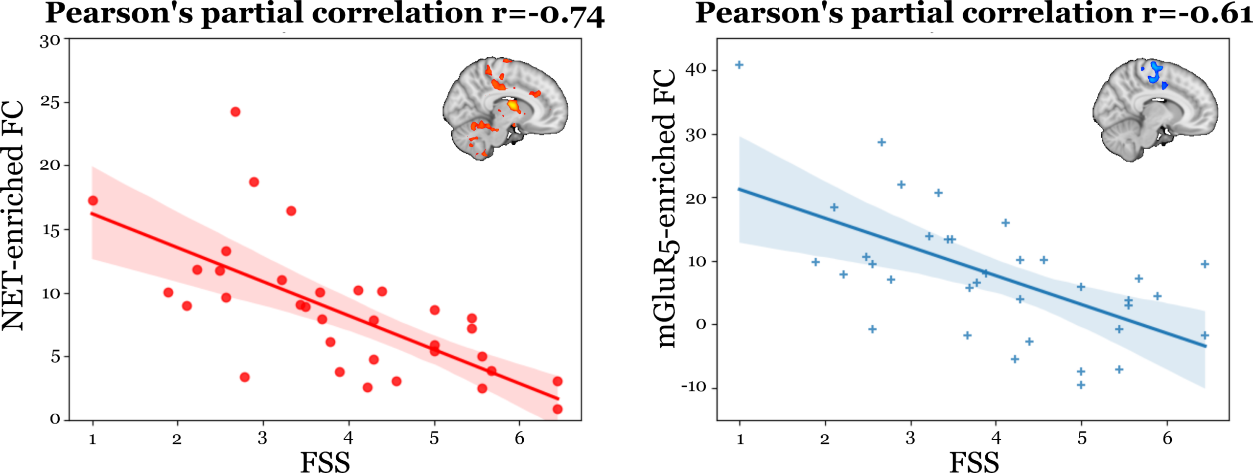 What are the molecular brain networks associated with fatigue in Parkinson’s disease?